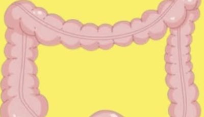 Learn How to Clean 13 Kilograms of Waste from Your Colon in One Night