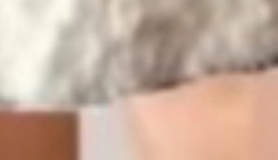 Face Lift with Natural Collagen! At 70 Years, Wrinkles Disappear in 3 Minutes! 🌟 (Baking Soda & Water Skin Care)