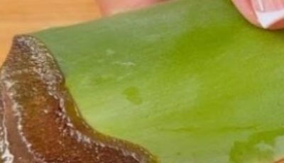 1000 Times Stronger Than Botox! Natural Collagen Aloe Vera! Erases All Wrinkles