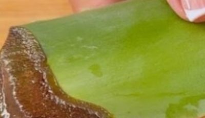 1000 Times Stronger Than Botox! Natural Collagen Aloe Vera! Erases All Wrinkles