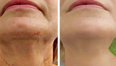 Bay Leaf Is 100,000 Times Stronger Than Botox? | Natural Wrinkle Eraser Even at Age 70!