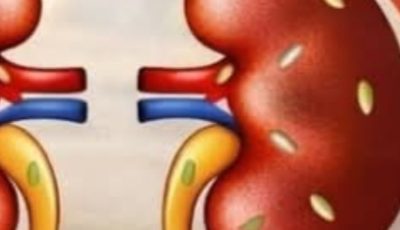 Exploring 5 Common Spices That May Support Kidney Health in Your Daily Routine