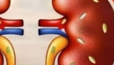 Exploring 5 Common Spices That May Support Kidney Health in Your Daily Routine