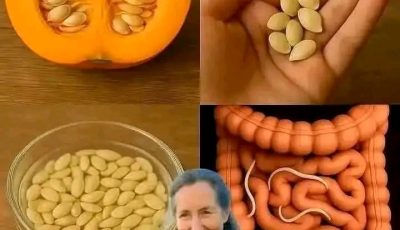FAMOUS DOCTOR REVEALS: Eat this and the parasites will disappear in 3 days