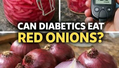 Pickled Red Onions