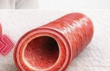 Say goodbye to blocked arteries with these powerful foods