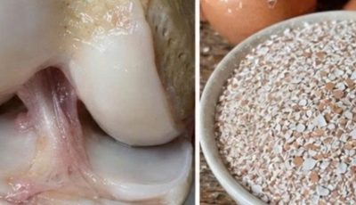 collagen, eggshells are a lifesaver. Recipe in the first comment.