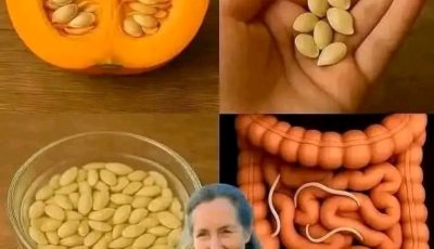 FAMOUS DOCTOR REVEALS: Eat this and the parasites will disappear in 3 days